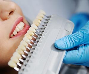 Preguntas Frecuentes Sobre Blanqueamiento Dental