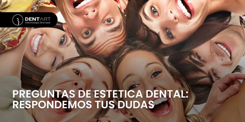 PREGUNTAS DE ESTETICA DENTAL: RESPONDEMOS TUS DUDAS