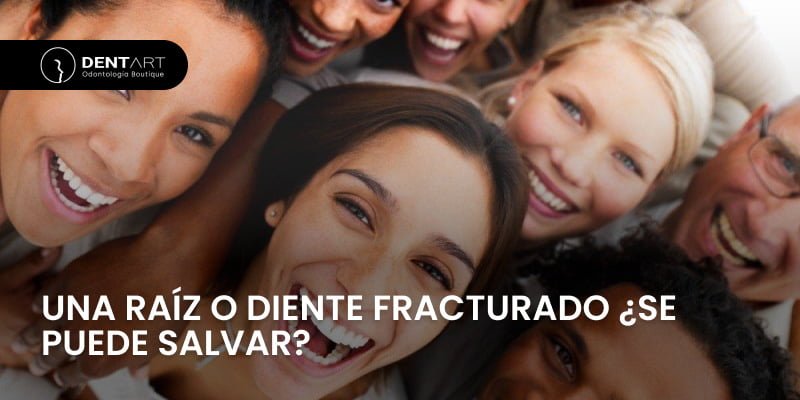 Una raíz o Diente Fracturado ¿Se puede salvar?
