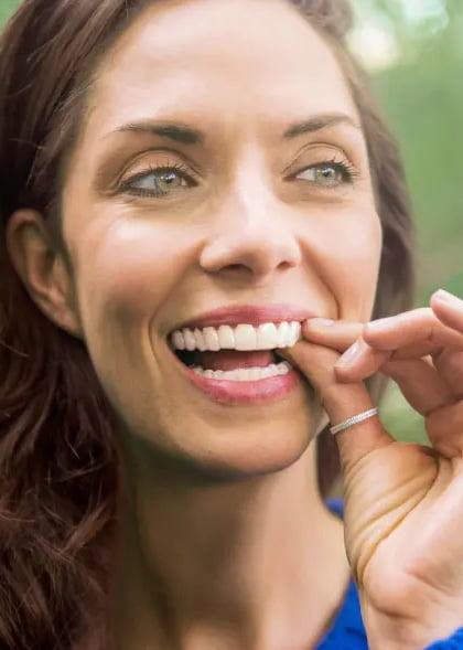 Invisalign Testimonio 2